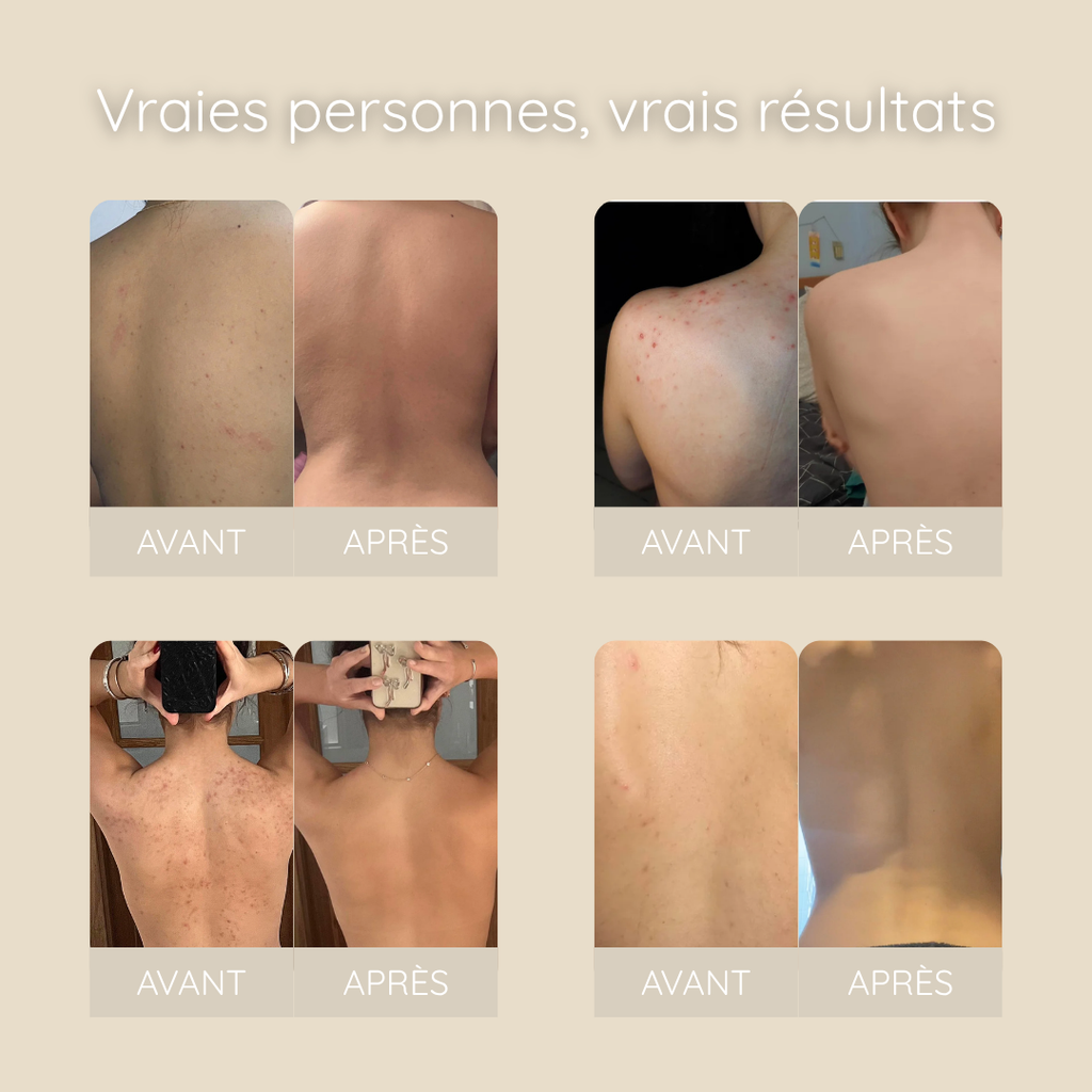SERVIETTE EXFOLIANTE BACNE