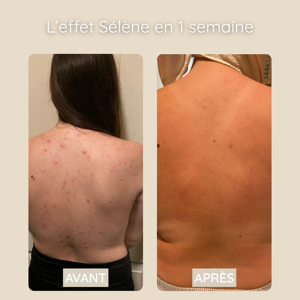 SERVIETTE EXFOLIANTE BACNE